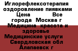 Иглорефлексотерапия, оздоровление пиявками › Цена ­ 3 000 - Все города, Москва г. Медицина, красота и здоровье » Медицинские услуги   . Свердловская обл.,Алапаевск г.